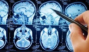 Neurology